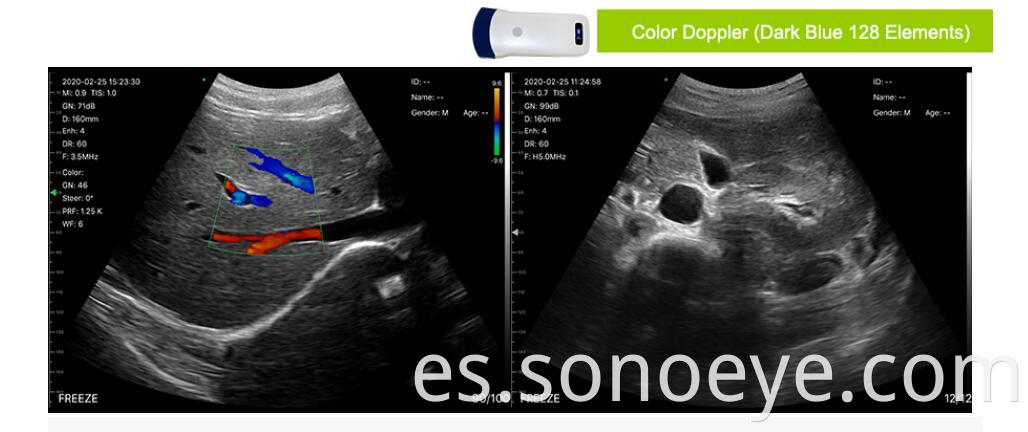 5c ultrasound